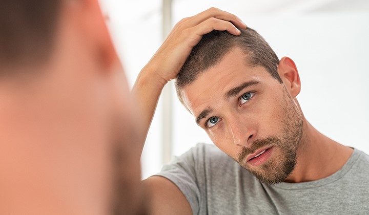 Mann mit Haarausfall Zinkmangel erkennen